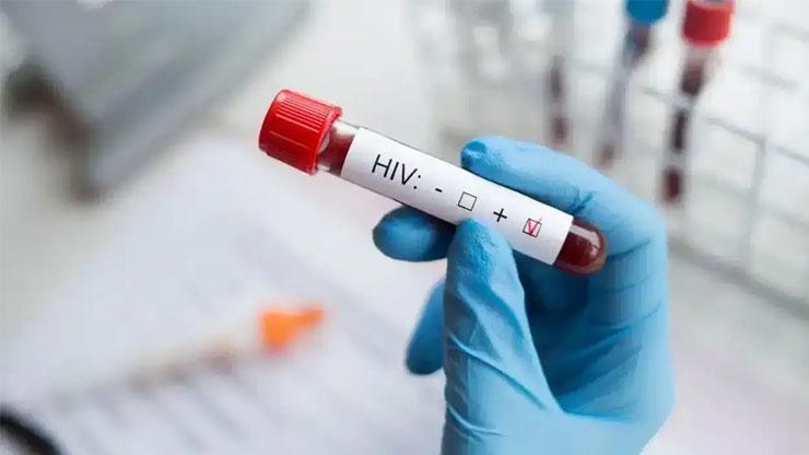 İzmir’de 13 yaşındaki çocuk AIDS’ten öldü Uzmanlardan şoke eden uyarılar: 15-19 yaşta HIV alarmı...